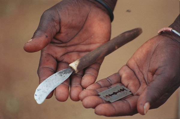 Mutilations génitales féminines : des séquelles qui traversent les années